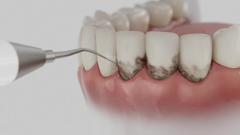 Reliable Dental Implants contractor in Henderson, KY by Smile Center Dentistry